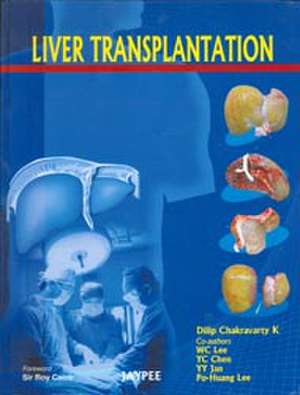 Liver Transplantation de Dilip K Chakravarty