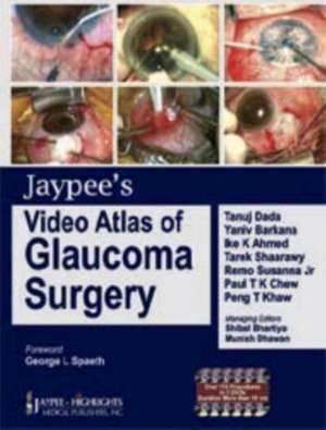 Jaypee's Video Atlas of Glaucoma Surgery de Tanuj Dada