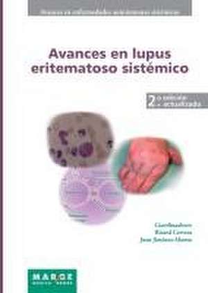 Avances en lupus eritematoso sistémico de Juan Jiménez Alonso