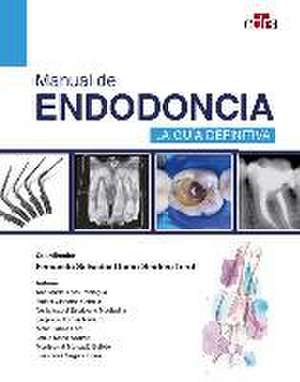 Manual de endodoncia. La guía definitiva