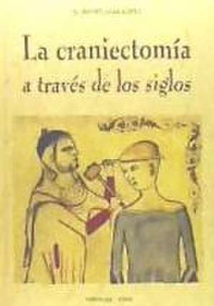 La craniectomía a través de los siglos de Rafael Vara López