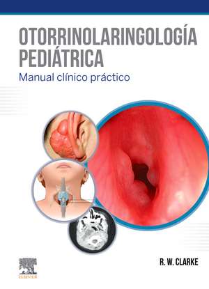 Otorrinolaringología pediátrica de Ray W. Clarke