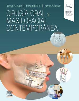 Cirugía oral y maxilofacial contemporánea de James R. Hupp