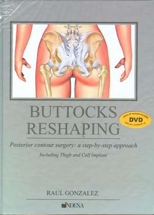 Buttocks Reshaping de Raul Gonzalez