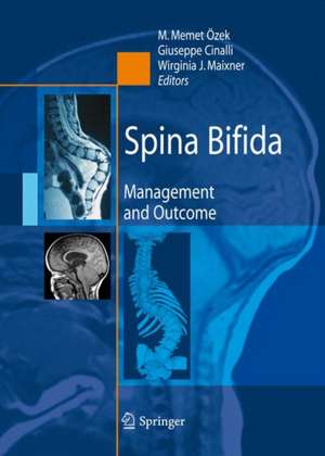 Spina Bifida: Management and Outcome de M. Memet Özek