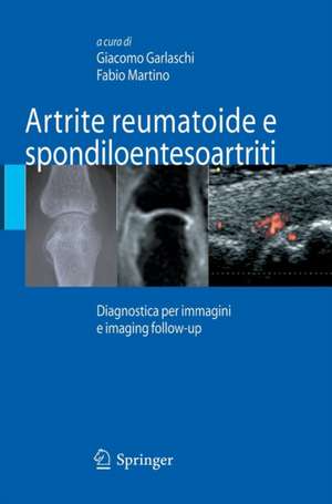 Artrite reumatoide e spondiloentesoartriti: Diagnostica per immagini ed imaging follow-up de Giacomo Garlaschi