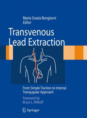 Transvenous Lead Extraction: From Simple Traction to Internal Transjugular Approach de Maria Grazia Bongiorni
