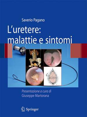 L'uretere: malattie e sintomi de Saverio Pagano