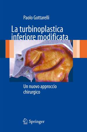 La turbinoplastica inferiore modificata: Un nuovo approccio chirurgico de Paolo Gottarelli