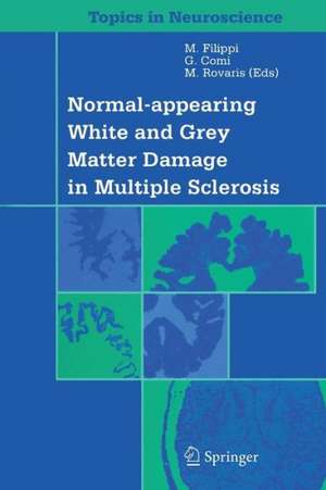 Normal-appearing White and Grey Matter Damage in Multiple Sclerosis de M. Filippi