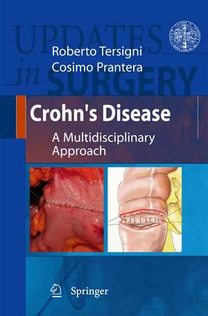 Crohn's Disease: A Multidisciplinary Approach de Roberto Tersigni