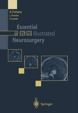 Essential Illustrated Neurosurgery de A. Fortuna