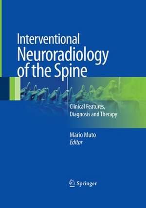 Interventional Neuroradiology of the Spine: Clinical Features, Diagnosis and Therapy de Mario Muto