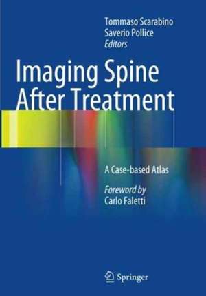 Imaging Spine After Treatment: A Case-based Atlas de Tommaso Scarabino