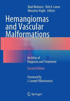 Hemangiomas and Vascular Malformations: An Atlas of Diagnosis and Treatment de Raul Mattassi