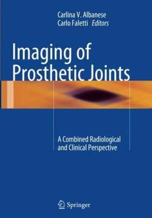 Imaging of Prosthetic Joints: A Combined Radiological and Clinical Perspective de Carlina V. Albanese