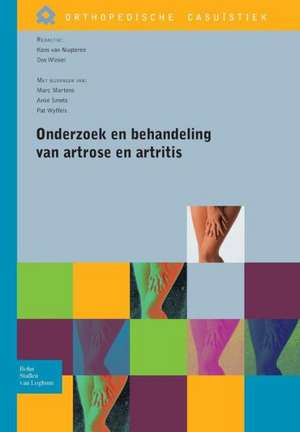 Onderzoek en behandeling van artrose en artritis de Koos van Nugteren