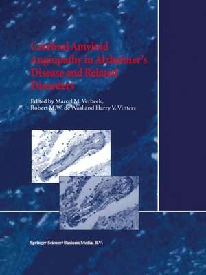 Cerebral Amyloid Angiopathy in Alzheimer’s Disease and Related Disorders de M.M. Verbeek