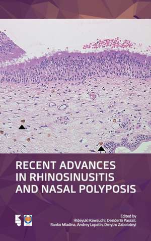 Recent Advances in Rhinosinusitis and Nasal Polyposis de Hideyuki Kawauchi