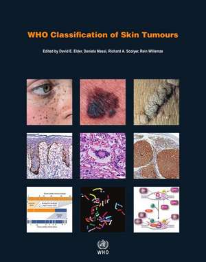 Who Classification of Skin Tumours de IARC