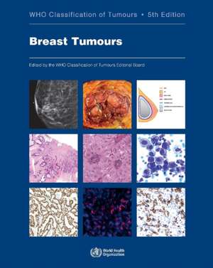 Breast Tumours de Who Classification of Tumours Editorial Board