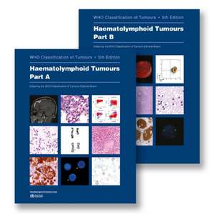 Haematolymphoid Tumours de Who Classification of Tumours Editorial Board