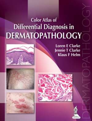 Color Atlas of Differential Diagnosis in Dermatopathology de Loren E Clarke