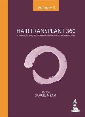 Hair Transplant 360 - Volume 3: Advances, Techniques, Business Development & Global Perspectives de Samuel M. Lam