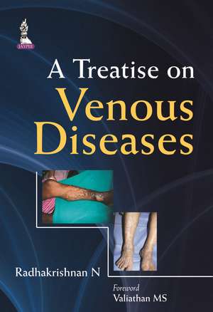 A Treatise on Venous Diseases de N Radhakrishnan