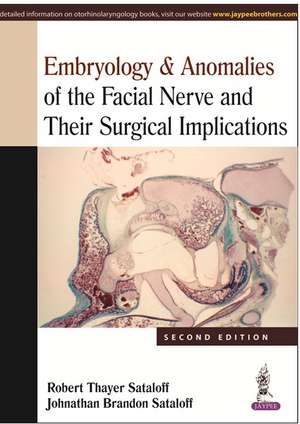 Embryology & Anomalies of the Facial Nerve and Their Surgical Implications de Robert Thayer Sataloff