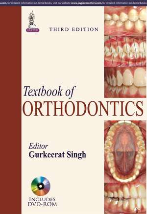 Textbook of Orthodontics de Gurkeerat Singh