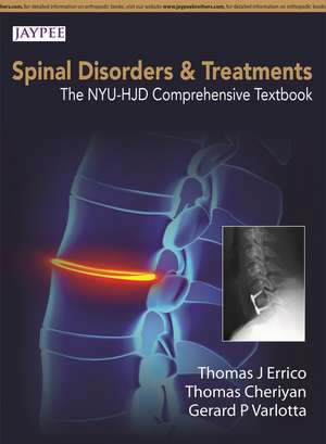 Spinal Disorders & Treatment: The NYU-HJD Comprehensive Textbook de Thomas J. Errico