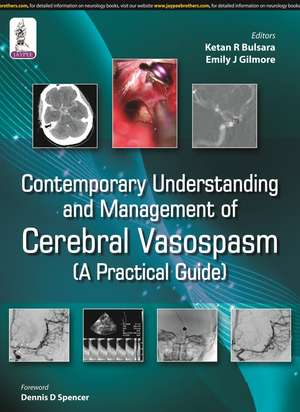 Contemporary Understanding and Management of Cerebral Vasospasm de Ketan R Bulsara