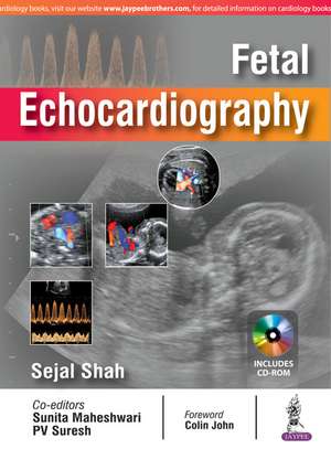 Fetal Echocardiography de Sejal Shah