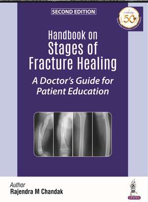 Handbook on Stages of Fracture Healing: A Doctor's Guide for Patient Education de Rajendra M Chandak