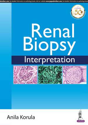 Renal Biopsy Interpretation de Anila Korula