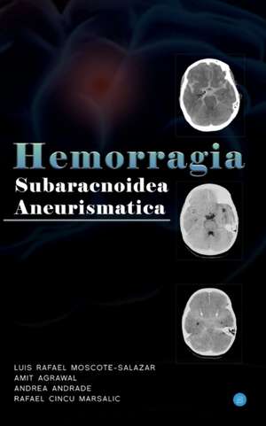 Hemorragia Subaracnoidea Aneurismatica de Amit Agrawal