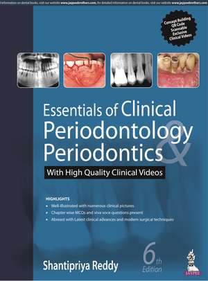 Essentials of Clinical Periodontology & Periodontics de Shantipriya Reddy