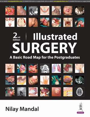 Illustrated Surgery: A Basic Road Map for Postgraduates de Nilay Mandal