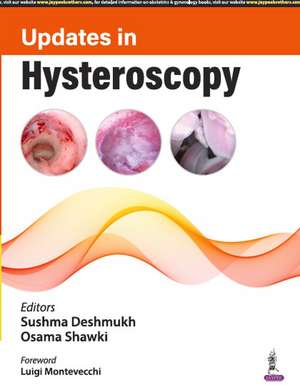 Updates in Hysteroscopy de Sushma Deshmukh