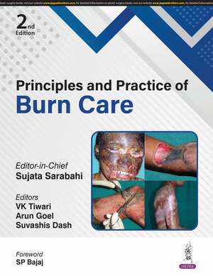 Principles and Practice of Burn Care de Sujata Sarabahi