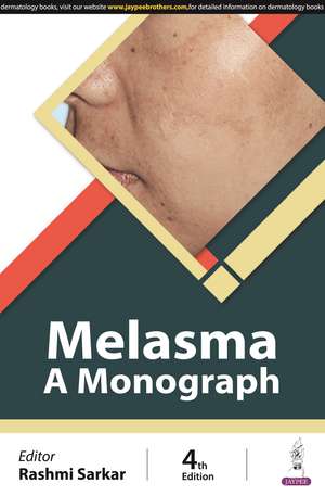 Melasma: A Monograph de Rashmi Sarkar