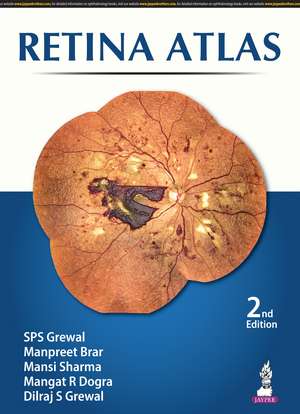 Retina Atlas de SPS Grewal