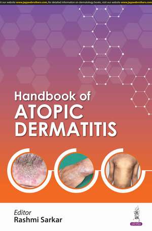 Handbook of Atopic Dermatitis de Rashmi Sarkar