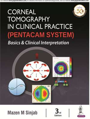 Corneal Tomography in Clinical Practice (Pentacam System): Basics & Clinical Interpretation de Mazen M. Sinjab