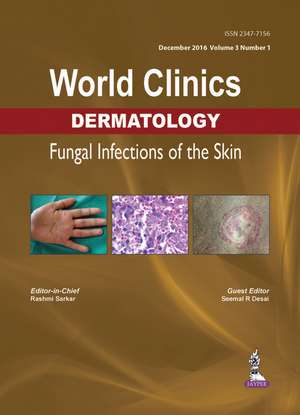 World Clinics Dermatology: Fungal Infections of the Skin: Volume 3, Number 1 de Rashmi Sarkar