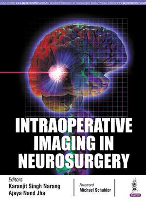 Intraoperative Imaging in Neurosurgery de Karanjit Singh Narang