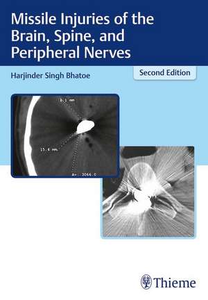 Missile Injuries of the Brain, Spine, and Peripheral Nerves de Harjinder S Bhatoe