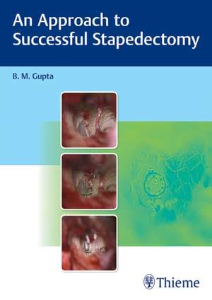 An Approach to Successful Stapedectomy de B M Gupta