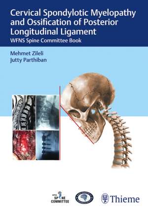 Cervical Spondylotic Myelopathy and Ossification – WFNS Spine Committee Book de Mehmet Zileli